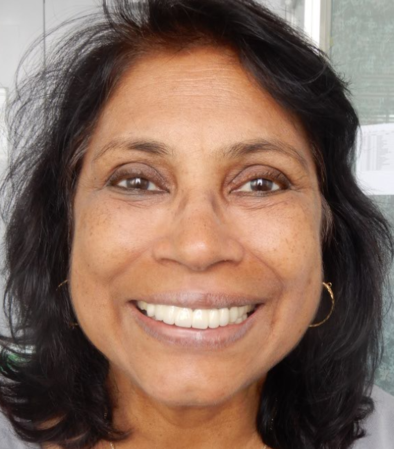  "Pre-operative wide smile photograph of a patient with terminal dentition, showing a shifted dental midline, an altered aesthetic cant, and a significant loss of lip support and labial fullness."
